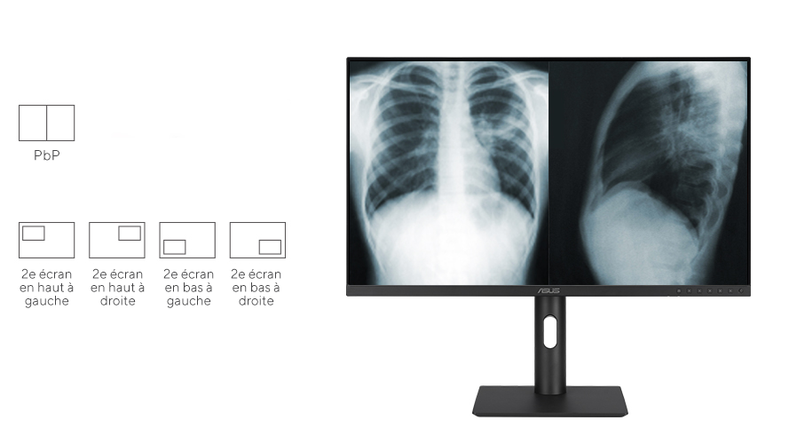 Démonstration que les écrans ASUS HealthCare prennent en charge la fonction PiP/PbP