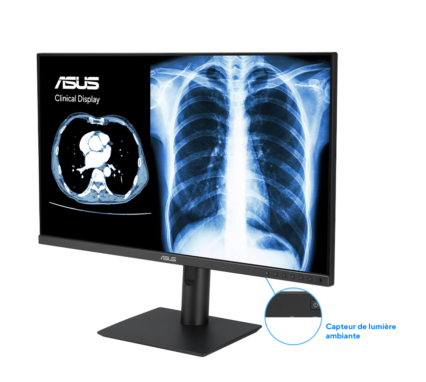 Indique la position du capteur de lumière ambiante sur les écrans ASUS HealthCare