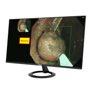 ASUS EndoAim AI Endoscopy System