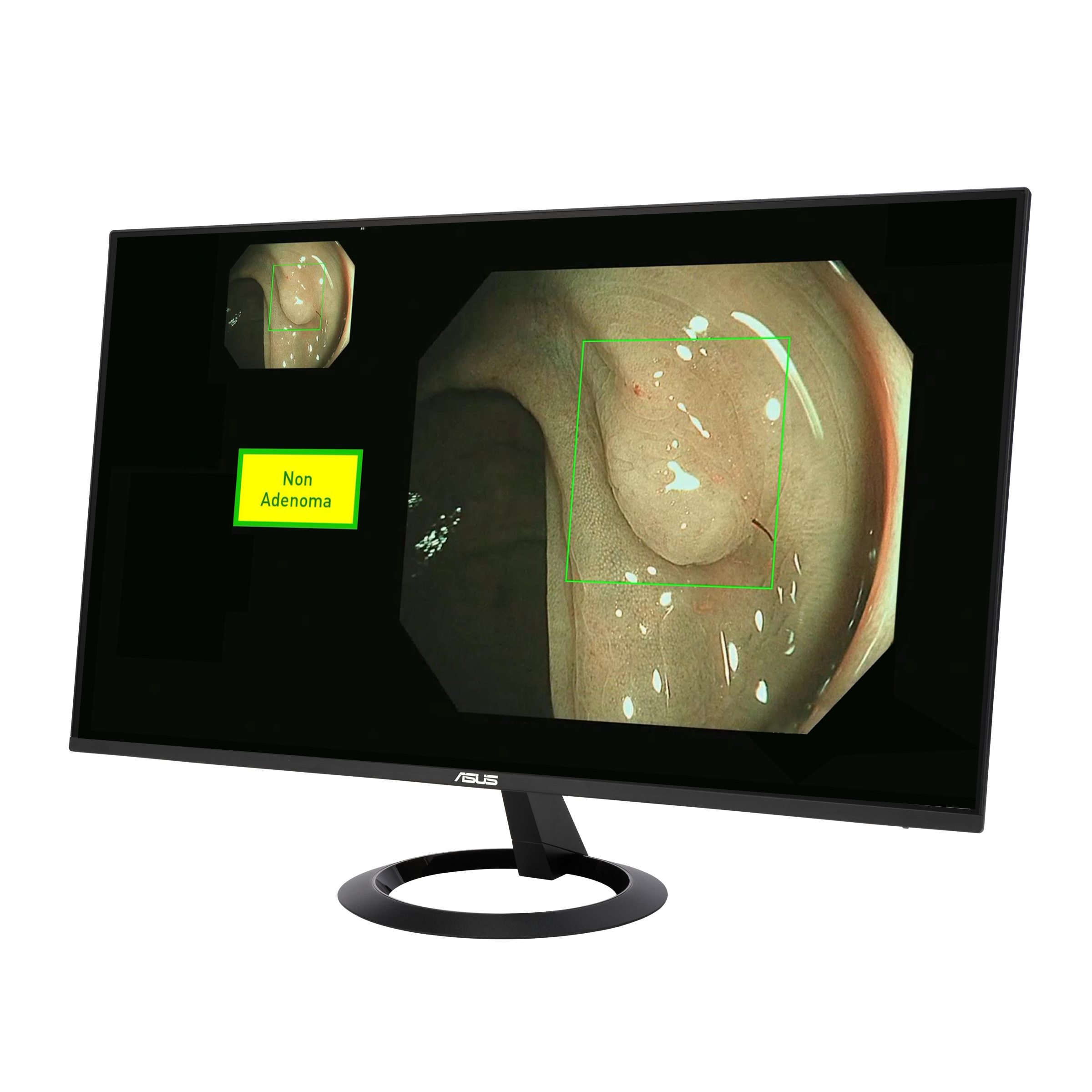 ASUS EndoAim Endoscopy AI Solution