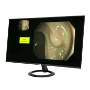 ASUS EndoAim Endoscopy AI Solution