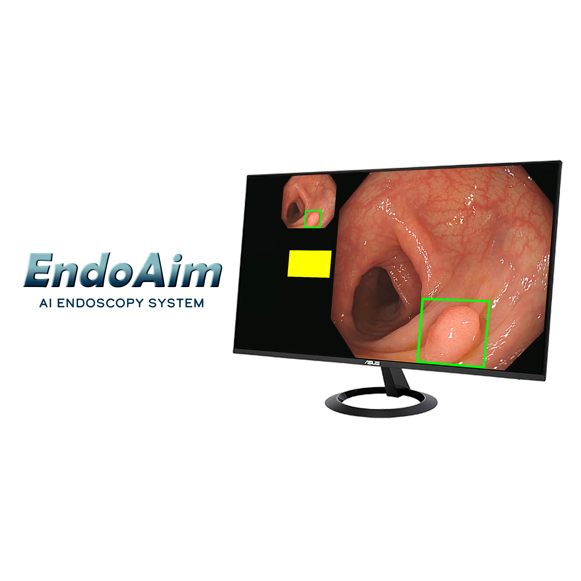 ASUS EndoAim Endoscopy AI Solution